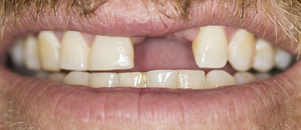 Case 1 before