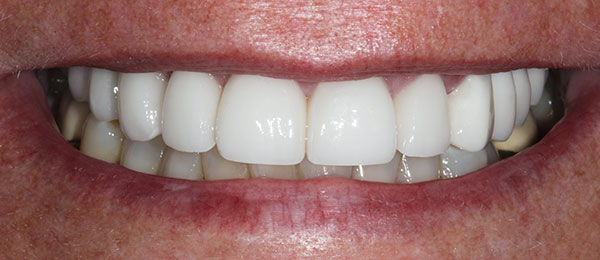 Case 2 after