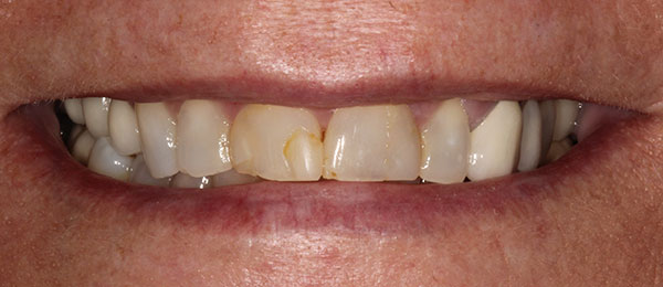 Case 2 before
