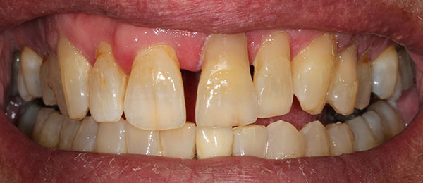 Case 3 before